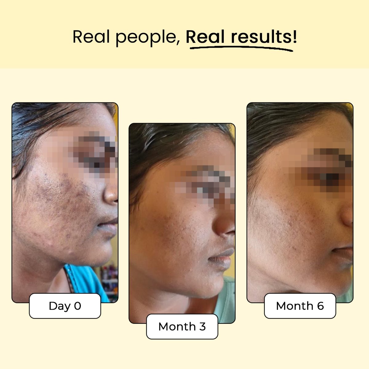 Skin Radiance combo: Dr. Su Glow x Grow and Dr. Su Gluta Glow supplement - Dr. Su Formulations