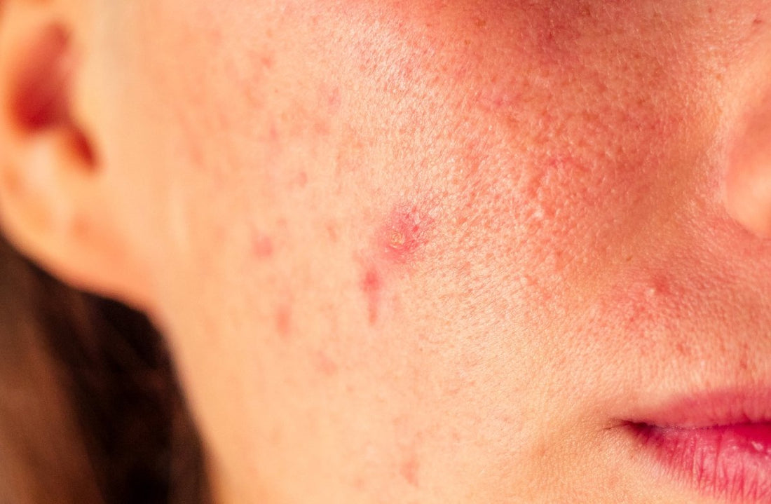 10 Signs Your Skin Barrier Is Damaged (and How to Fix It in 2 Weeks) - Dr. Su