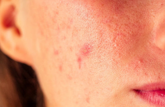 10 Signs Your Skin Barrier Is Damaged (and How to Fix It in 2 Weeks) - Dr. Su