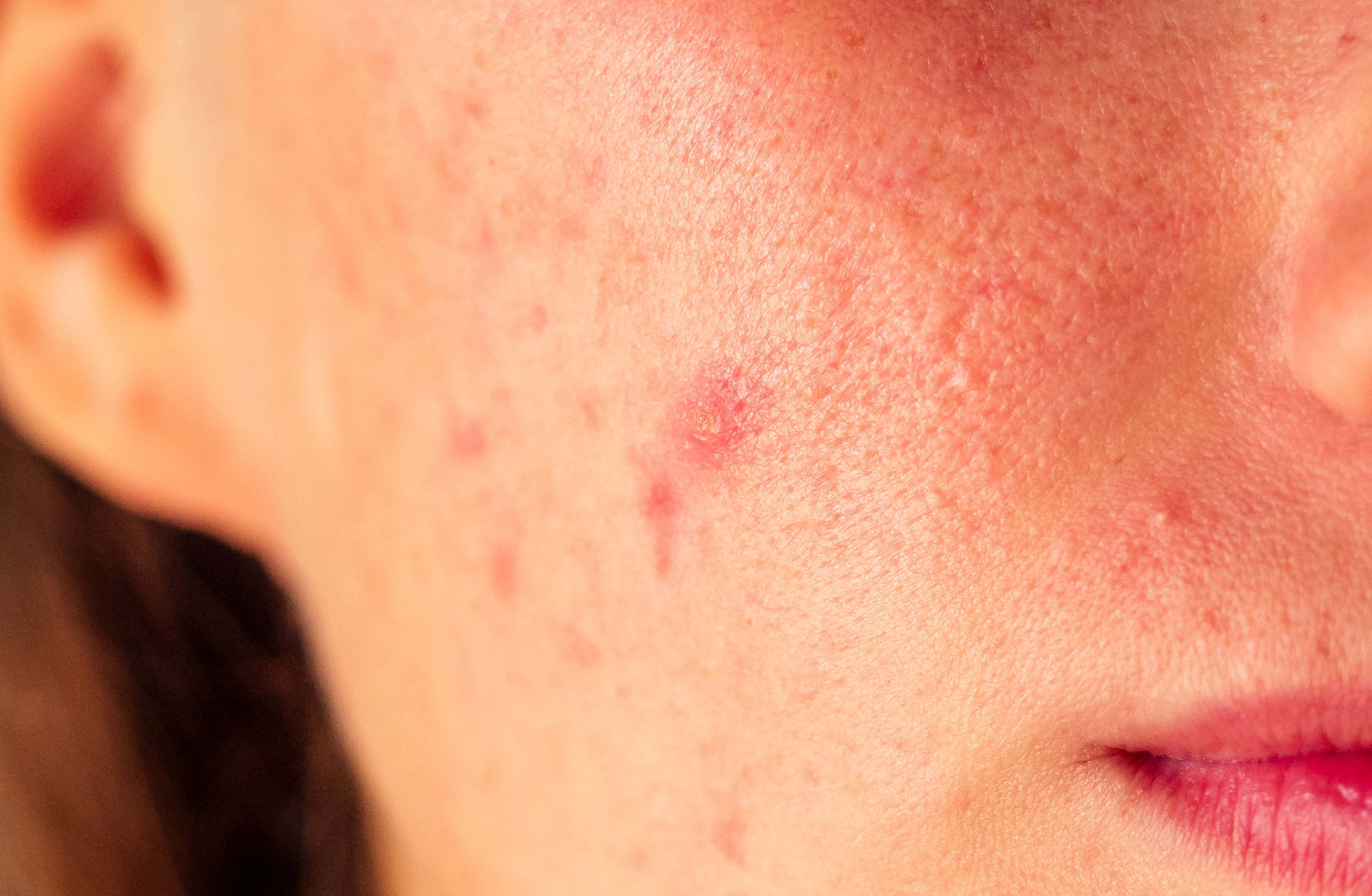 10 Signs Your Skin Barrier Is Damaged (and How to Fix It in 2 Weeks)
