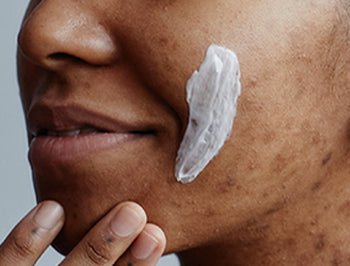 8 Skincare Mistakes That Worsen Hyperpigmentation (Dermatologist Explains) - Dr. Su