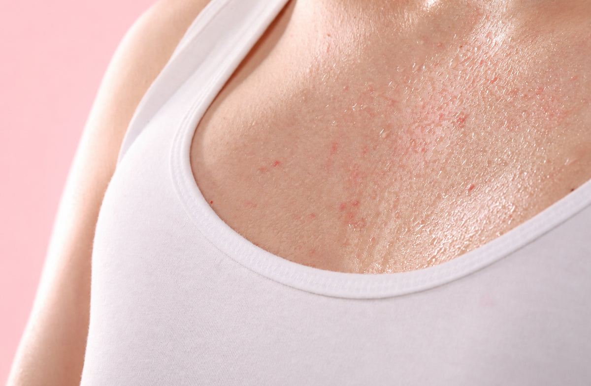 Does Sweat Trigger Breakouts? Here’s What Science Says