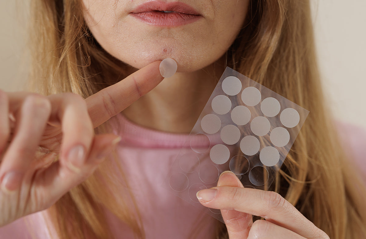 Hydrocolloid Patches for Acne: Do They Really Work?