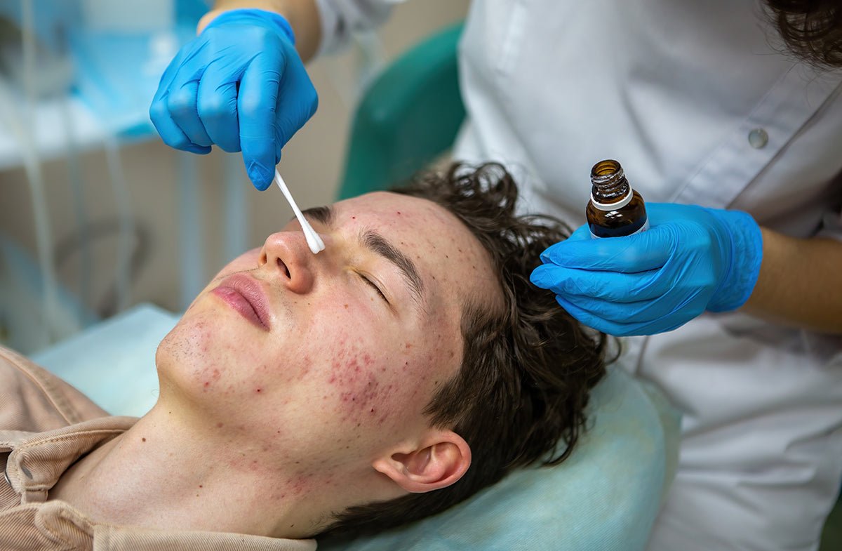 Acne Spot Treatments: What Works Best According to Dermatologists