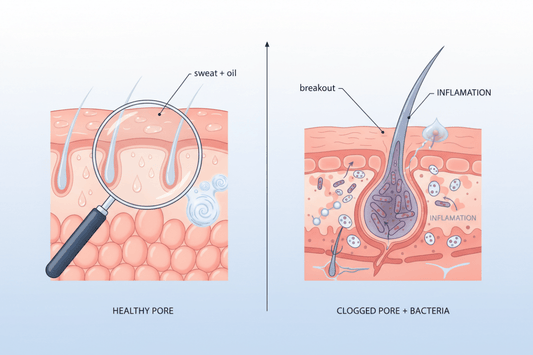 Does Sweat Trigger Breakouts? Here’s What Science Says - Dr. Su Formulations