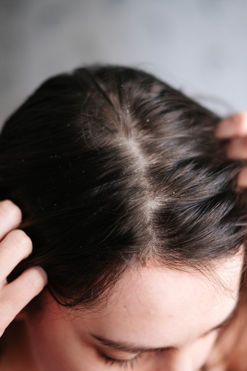 How To Tell If You Have A Damaged Scalp Barrier (And How To Fix It)