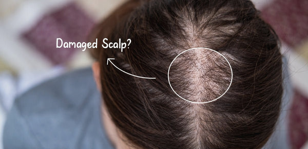 How To Tell If You Have A Damaged Scalp Barrier (And How To Fix It)