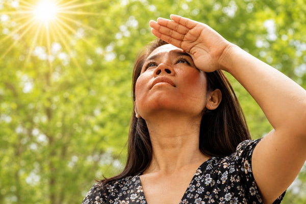 Hyperpigmentation In Summer: Daily Habits That Actually Prevent Dark Spots