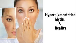 Hyperpigmentation Myths Debunked: What Your Skin Really Wants You to Know - Dr. Su Formulations