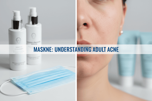 Maskne Is Real: Causes, Prevention & Treatments That Work - Dr. Su Formulations