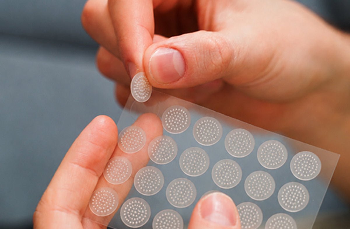 Microneedling Patches for Pimples: How They Compare to Spot Treatments