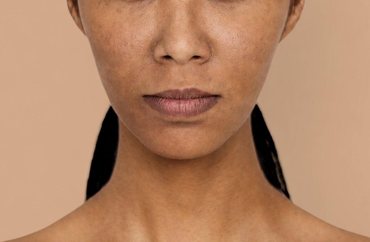 Skin Pigmentation: Causes & Solutions!
