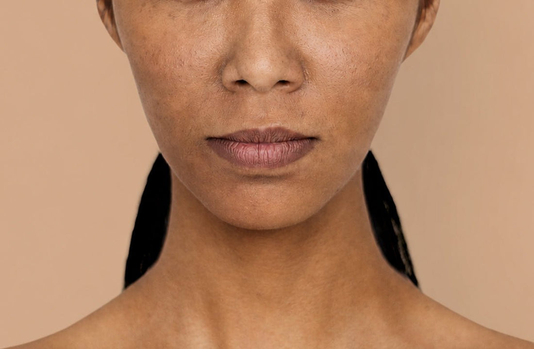 Skin Pigmentation: Causes & Solutions! - Dr. Su