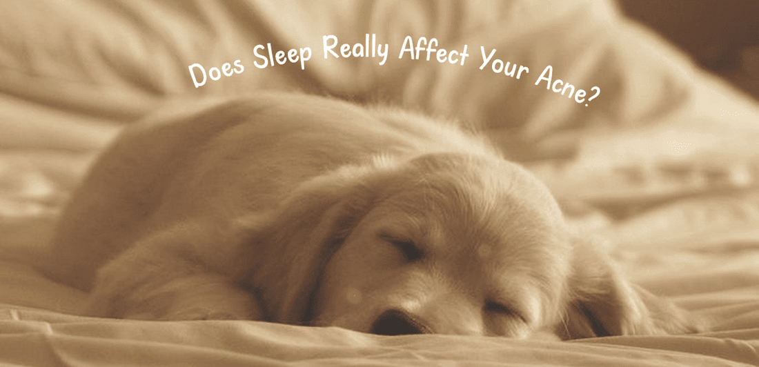 The Sleep Acne Connection: Does Sleep Really Affect Your Acne? - Dr. Su
