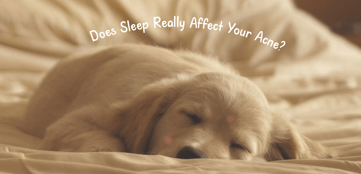 The Sleep Acne Connection: Does Sleep Really Affect Your Acne?