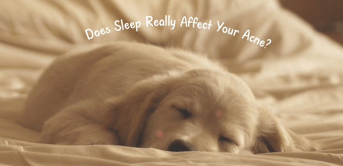 The Sleep Acne Connection: Does Sleep Really Affect Your Acne? - Dr. Su Formulations
