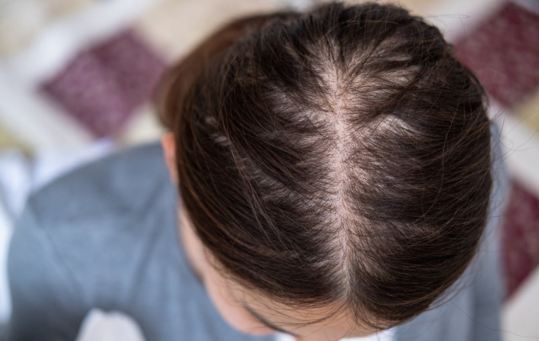 Why Is My Hair Getting Thinner as I Age? Let’s Break It Down! - Dr. Su