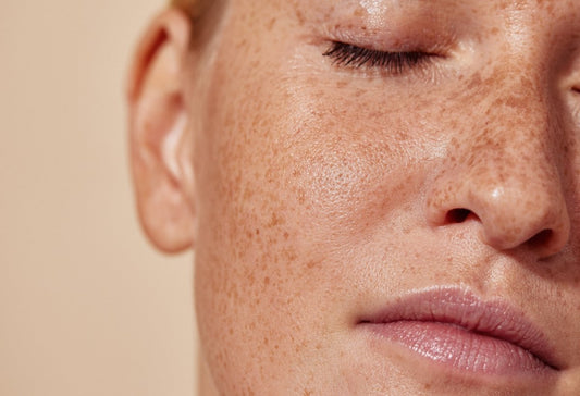 Why Pigmentation Comes Back After You Stop Treatments And What To Do - Dr. Su