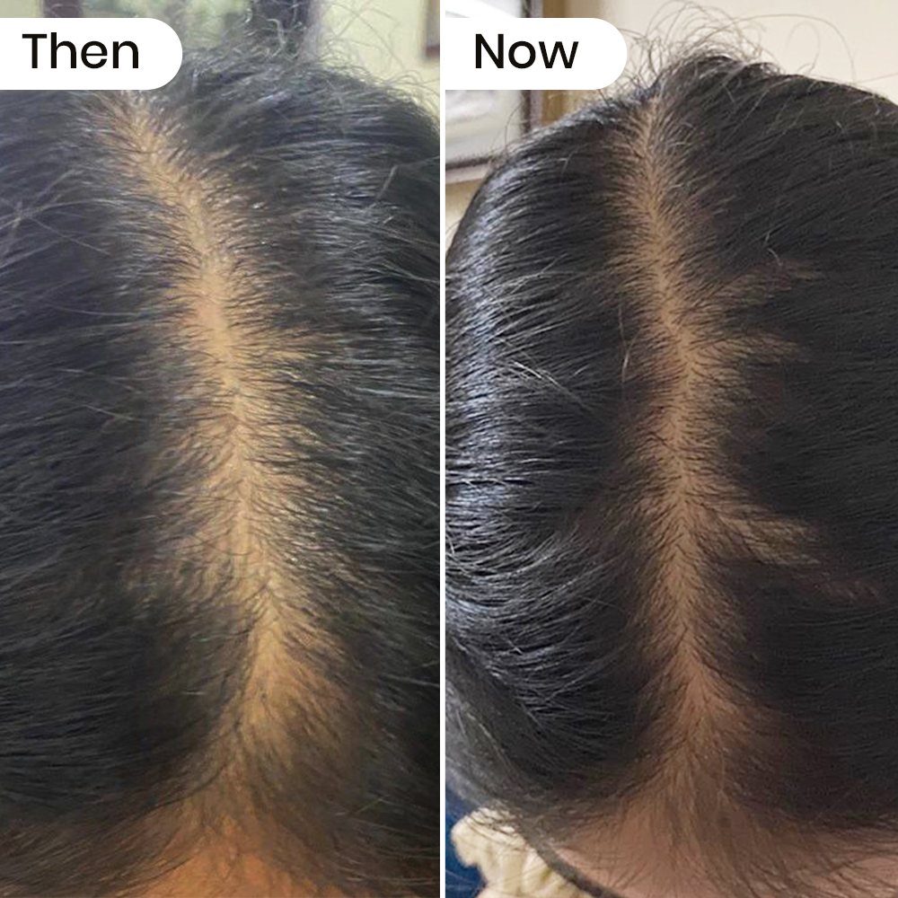 Rescue Hair Nourishing Oil