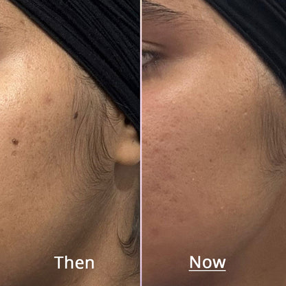 Exosome Plump Party Serum (30ml)