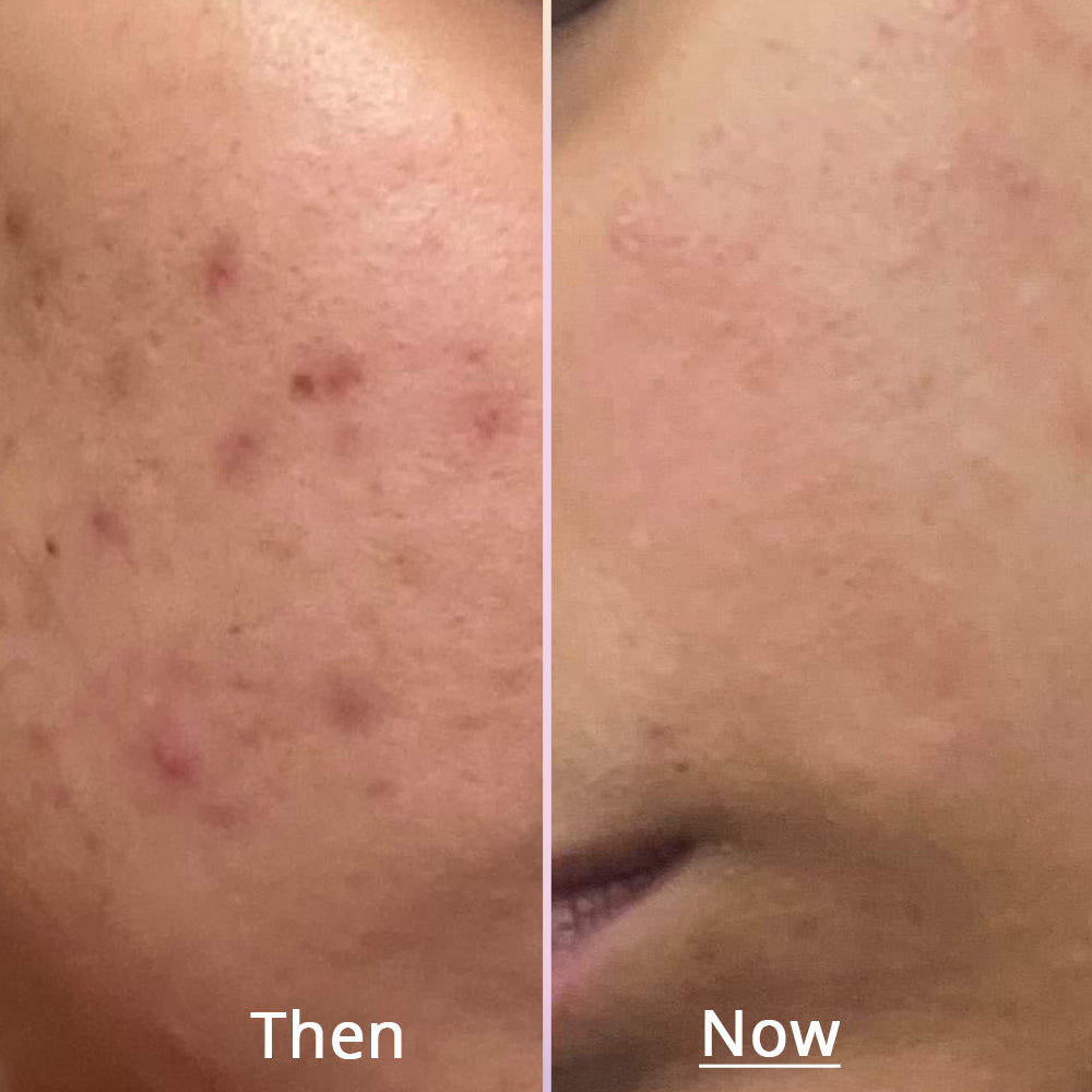 Glow x Grow for Skin, Hair and Gut