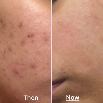 Glow x Grow for Skin, Hair and Gut