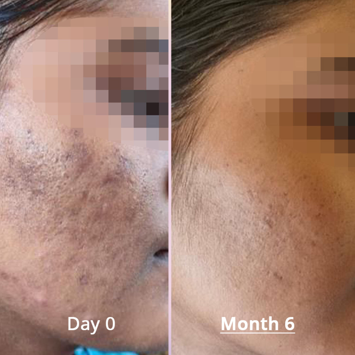 Gluta Glow 500mg Skin Radiance Supplement