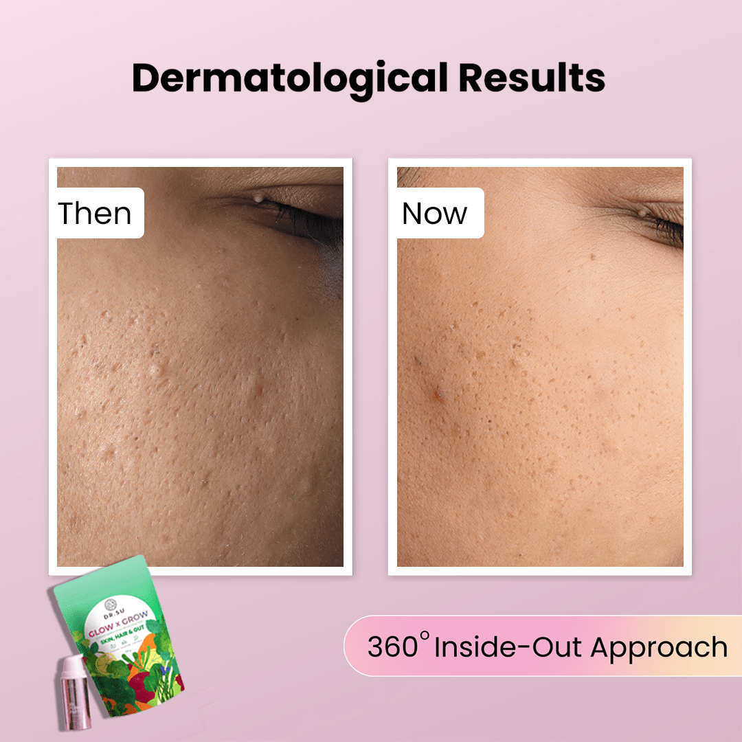 Barrier Repair Combo - Dr. Su