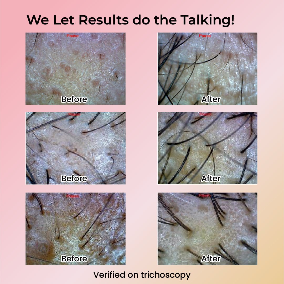 Dr. Su Hair Rescue Duo - Dr. Su Formulations