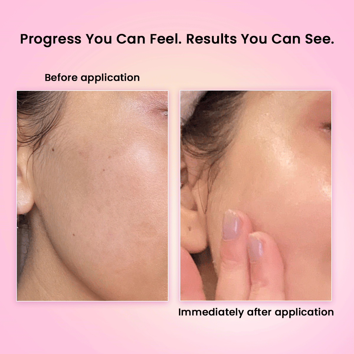 Exosome Plump Party Serum (30ml) - Dr. Su Formulations