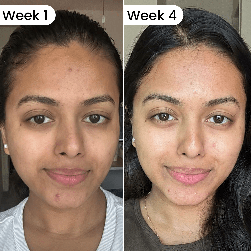 Exosome Plump Party Serum (30ml) - Dr. Su Formulations