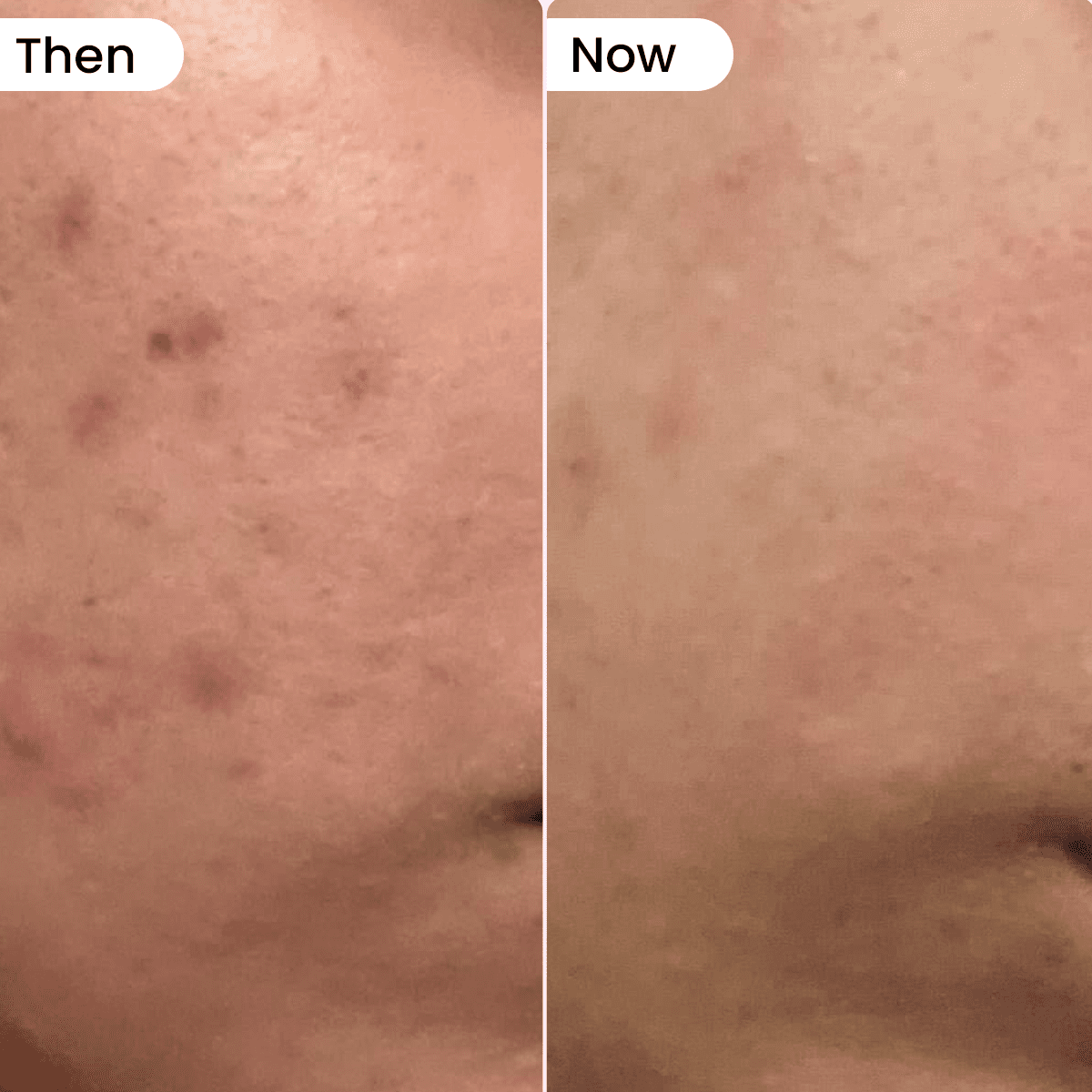 Glow x Grow for Skin, Hair and Gut - Dr. Su Formulations