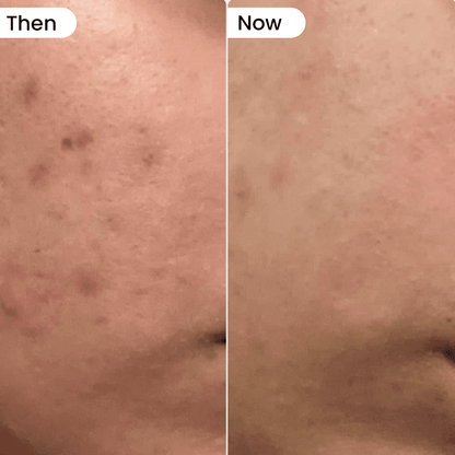 Glow x Grow for Skin, Hair and Gut - Dr. Su Formulations