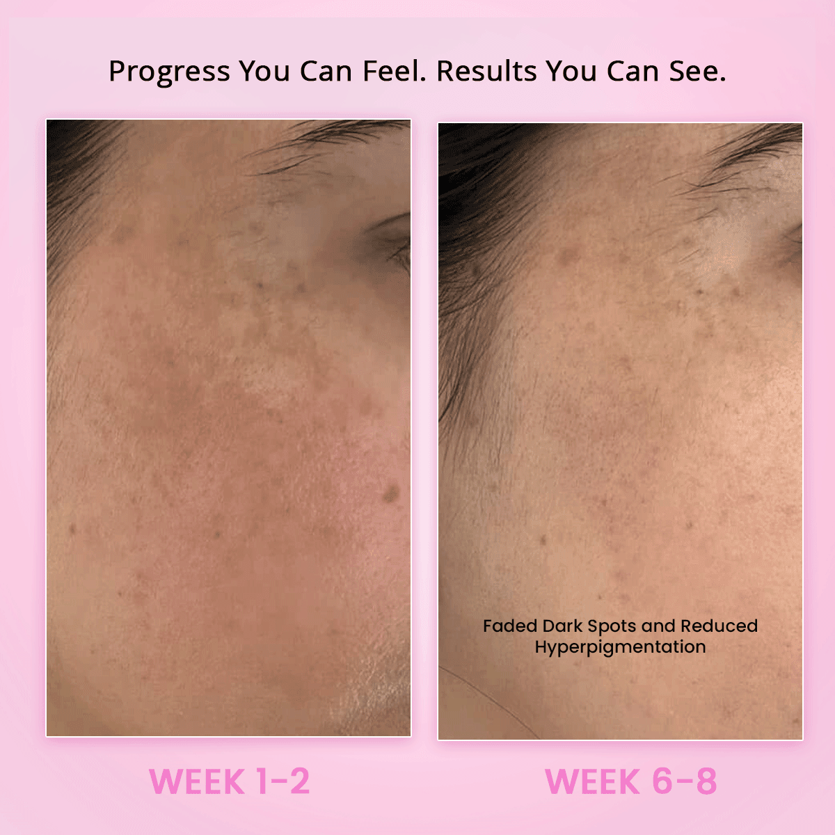 Gluta Glow 500mg Skin Radiance Supplement - Dr. Su Formulations