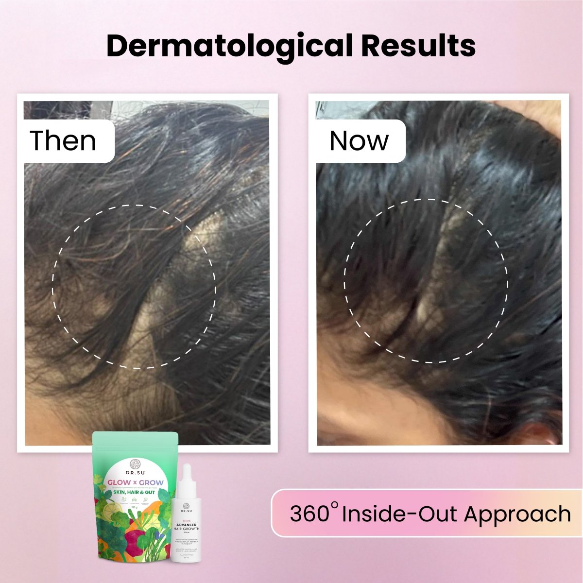 Hair Growth Combo - Dr. Su