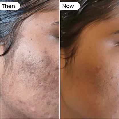 Liposomal Gluta Glow for skin radiance - Dr. Su