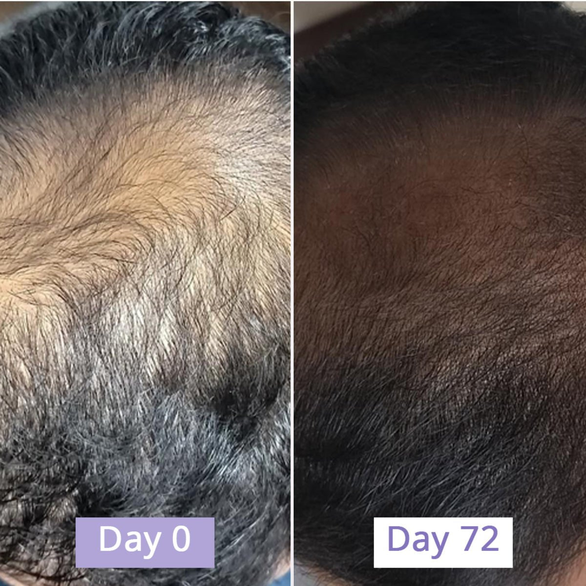 Revive Hair Growth Serum - Dr. Su Formulations