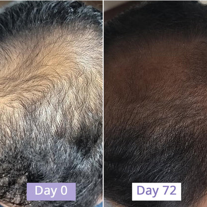 Revive Hair Growth Serum - Dr. Su Formulations