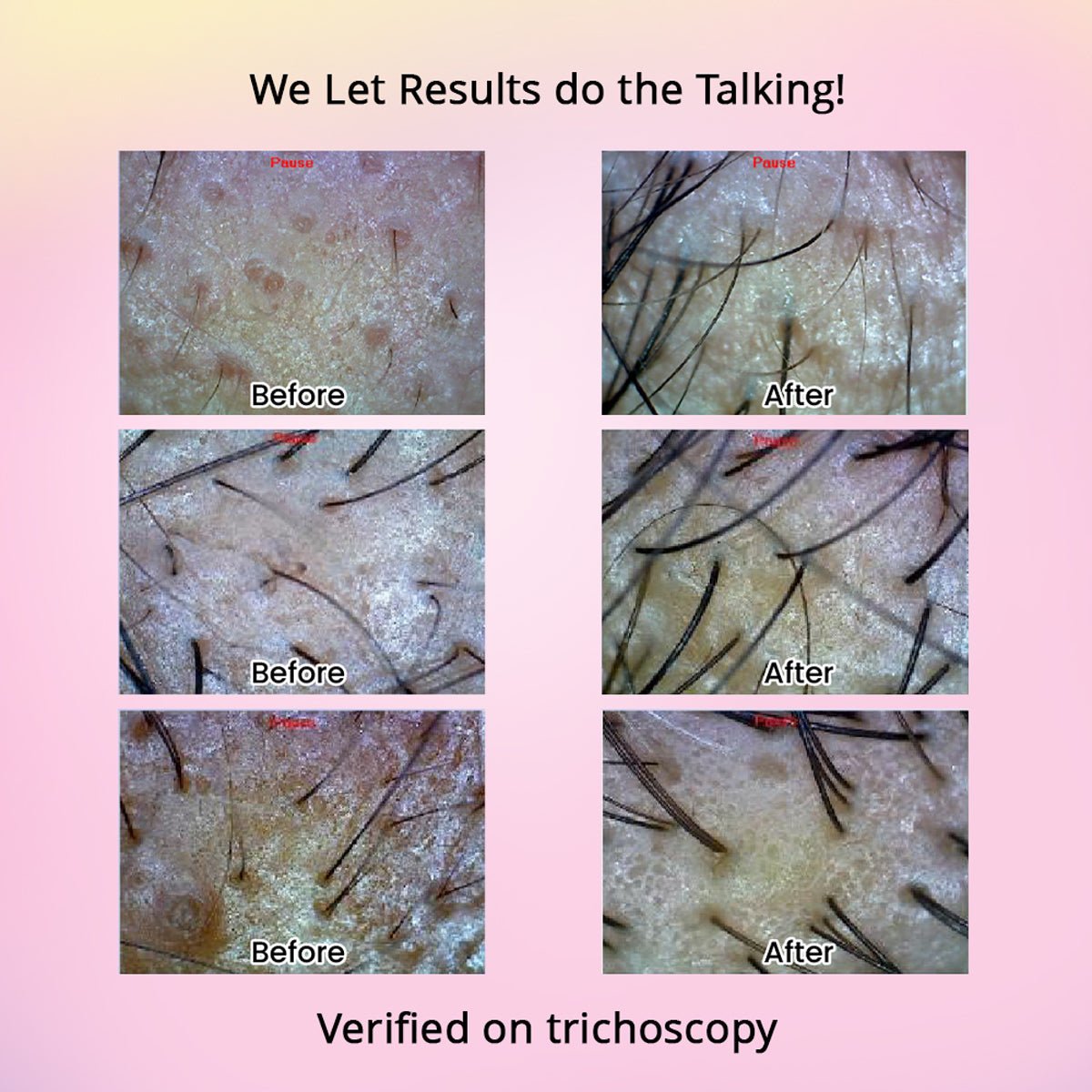 Revive Hair Growth Serum - Dr. Su Formulations