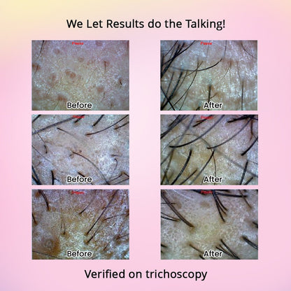 Revive Hair Growth Serum - Dr. Su Formulations