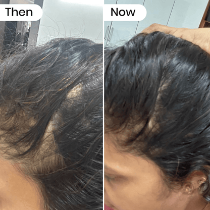 Revive Hair Growth Serum - Dr. Su